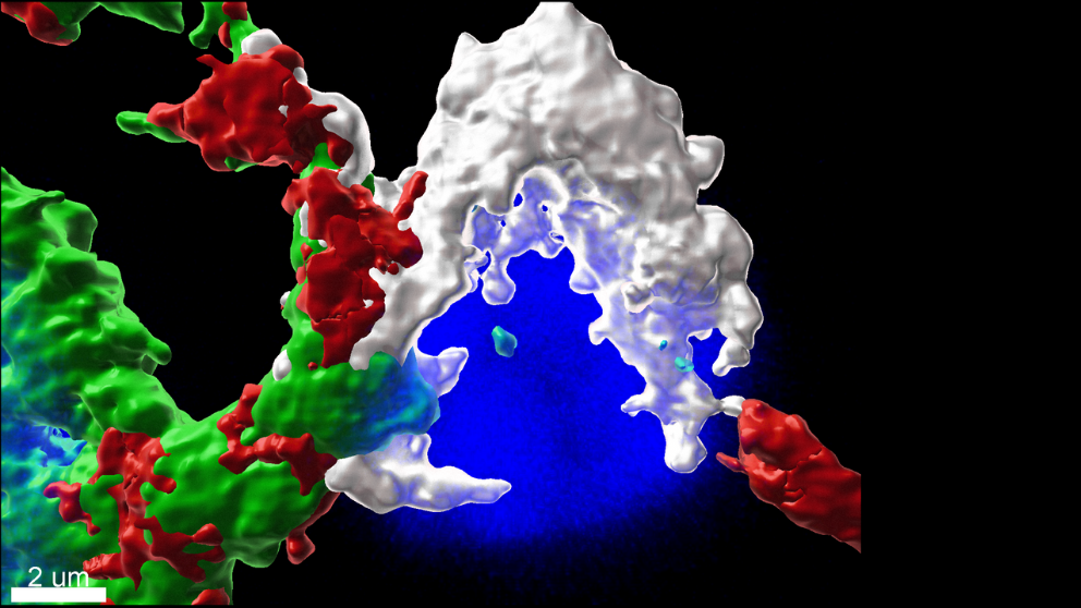 growing cancer cells