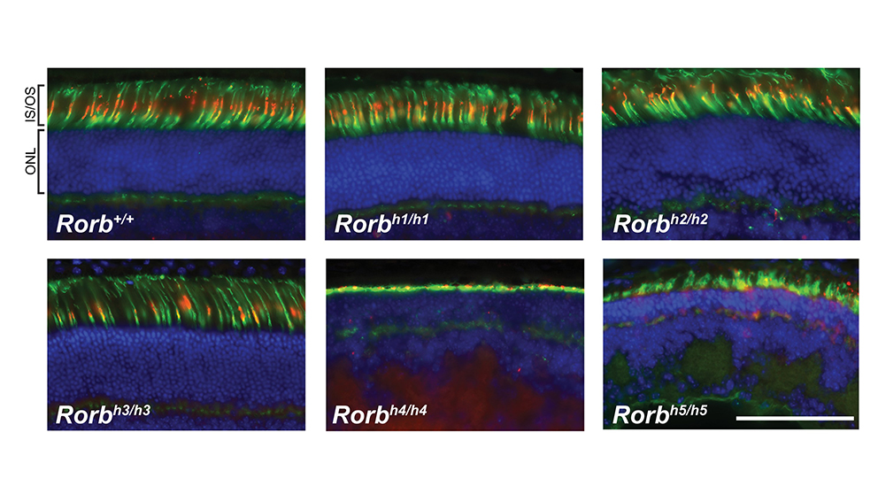 An example of RORβ research from The Jackson Laboratory's Abigail Tadenev