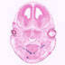 p63-cre Craniofacial Characterization